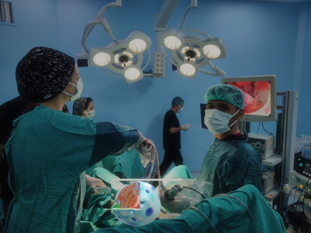 Şırnak devlet hastanesinde Laparoskopik Myomektomi operasyonu yapıldı.